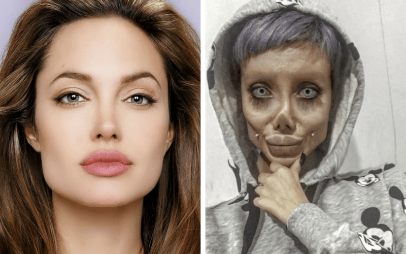 sahar-tabar-operations-ressembler-angelina-jolie-jewanda6